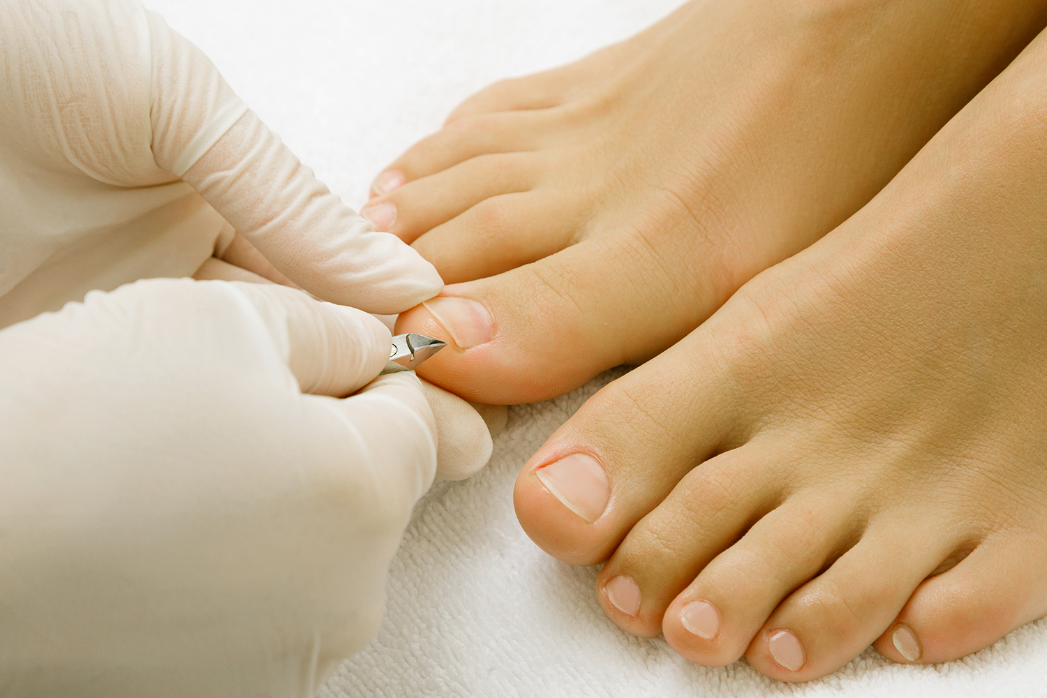 The Truth About Ingrown Toenails: Causes, Myths & Treatment Options